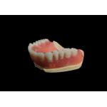 Comfortable Complete Acrylic Denture Offering Secure Fit Long Lasting Strength and Natural Appearance for Dental Clinics for sale