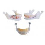 China Dentist teeth model Mandibular Model with Nerves , Arteries and Veins for sale