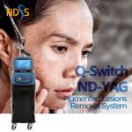 532nm 755nm 1064nm Pico Laser Machine For Beauty Salon for sale