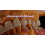 Layered Dental Zirconia Crown And Bridge Translucency 3D PRO Zirconia Porcelain Crown Standard Dental Lab for sale