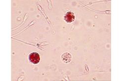 China Simple Operate Men'S Fertility Test Kit Semen Leukocytes Test Kit Peroxidase Staining supplier