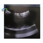 GE Voluson E10 Ultrasound Machine Repair Image Anomaly Replace Rfm Board for sale