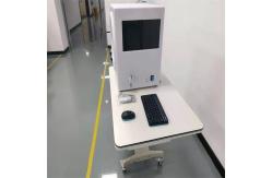 China CE Peripheral Vision Test Equipment Glaucoma Examination supplier