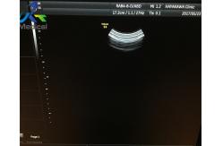 China GE RAB4-8-D Wideband Curved Transducer Convex Array Ultrasound Probe Medical Scanner supplier