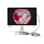 TUYOU 4K Rigid Endoscopy Camera System For Cyst Fenestration Liver And ENT Surgery for sale