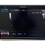Oringal Ultrasound Repair Service Aloka F37 Main Board Start Normal But No Scan Area for sale
