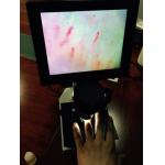 Magnification 400 Times Digital Microcirculation Microscope Nailfold Microcirculation Equipment for sale