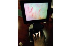China Magnification 400 Times Digital Microcirculation Microscope Nailfold Microcirculation Equipment supplier