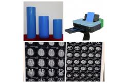 China High Image Stability Medical X Ray Films 210 Microns Blue Substitute Fuji Film supplier