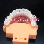 Biocompatible Tooth Colored Zirconia Dental Implant Bridge for sale