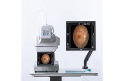 China High Resolution Automated Fundus Camera with FFA or FAF, mosaic function supplier