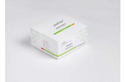 China CE Progesterone Prolactin Test Kit supplier