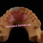 Dental Valplast Flexible Flipper Dentures Removable Partial Denture for sale