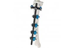 China Condylar External Fixation Device supplier