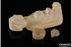 China Emax Dental Inlays And Onlays Fracture Resistant 1.5mm Low Translucency supplier
