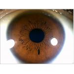 Green Iris Recognition Camera Iridology Device English Spanish Chinese for sale