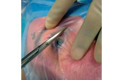 China Ophthalmic Formable Molder Disposable Sterile Surgical Drapes With Cable Holder supplier