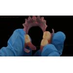 Dental TCS Valplast Flexible Partial Dentures Nesbit Valplast Finish China Dental Lab Valplast Clasp for sale