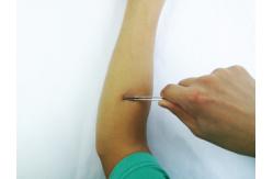 China Streamlined Trauma Disposable Surgical Stapler Skin Stitching Stapler supplier