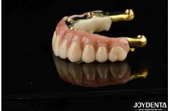 China Dental Prosthesis Ti-Bar Zirconia Hybrid Bridge With High Biocompatibility Standards supplier
