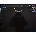 GE Voluson E10 Ultrasound Machine Repair Abnormal Image Faulty Test