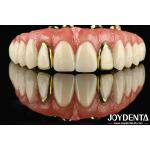 Experience The Durability Of Titanium Malong Hybrid Bridge For Applicable Dentistry for sale