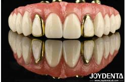 China Experience The Durability Of Titanium Malong Hybrid Bridge For Applicable Dentistry supplier