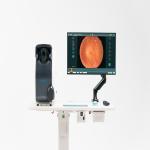 Binocular capture automatically wide field fundus camera with one key operation for ophthalmic medical devices for sale
