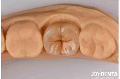 China High Precision Applications Full Zirconia With High Resistance To Thermal Shock supplier