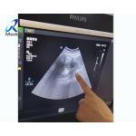 EPIQ 5 Ultrasound Machine Repair Dark Channels In The Sound Area Replace ACQ for sale