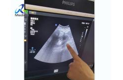 China EPIQ 5 Ultrasound Machine Repair Dark Channels In The Sound Area Replace ACQ supplier