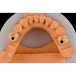 Internal Hex Connection Sandblasted Titanium Dental Implants Single Tooth Replacement