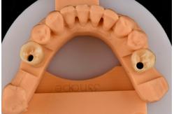 China Internal Hex Connection Sandblasted Titanium Dental Implants Single Tooth Replacement supplier