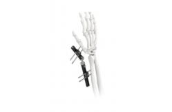 China Orthopedic Wrist External Fixator Standard Single sided Integrated supplier
