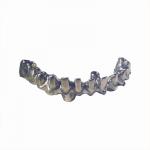 Denture Cobalt Chromium Molybdenum Alloy CAD CAM Metal Bar Material for sale