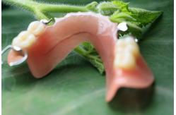 China Partial Removable Acrylic Partial Denture supplier