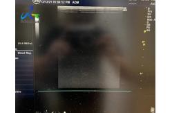 China GE Logiq S6 Ultrasound Machine Repair Displays Virtual Plot And No Echo Zone supplier