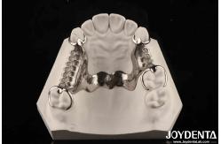 China Clinical Practice Dental Alloying Metal Framework Good Fit In The Mouth Technology supplier