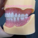 Durable Dental Prosthesis Full Arch Acrylic Teeth Partial Removable Dentures for sale