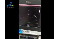 China EPIQ 5 Ultrasound Machine Repair Abnormal Image Snowflake Interference Replace ACQ supplier