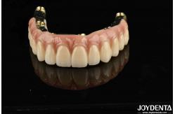 China Dental Prosthesis Ti-Bar Zirconia Hybrid Bridge With High Biocompatibility Standards supplier