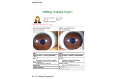 China Green Iris Recognition Camera Iridology Device English Spanish Chinese supplier