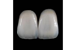 China High Translucency Emax Porcelain Veneers Crown with Better Materials by Ivoclar Vivadent supplier