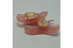 China Flexible Valplast Dentures For Natural Comfort And Aesthetic Quality supplier
