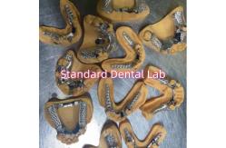 China Removable Cobalt Chrome Cast Metal Framework Partial Dentures supplier