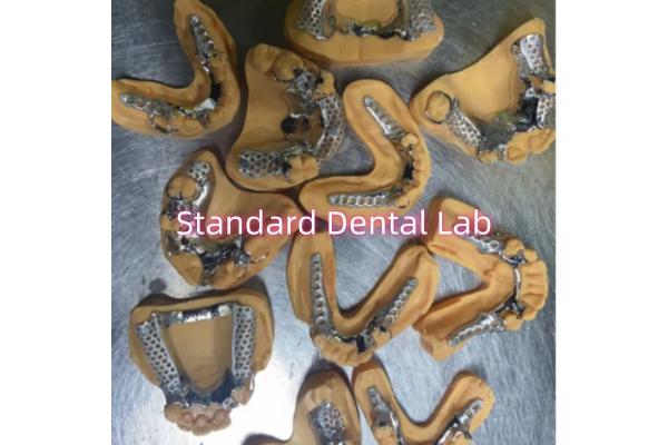Removable Cobalt Chrome Cast Metal Framework Partial Dentures