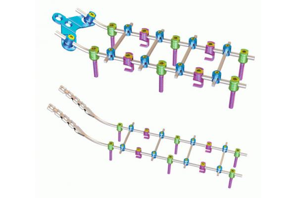 Titanium Orthopedics Posterior Cervical Fixation System