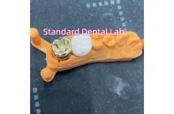 China Non Precious Yellow Metal Alloy Crown Full Cast With Zirconia Crown supplier