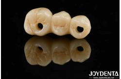 China High Aesthetics High Flexural Strength 1000 MPa Full Zirconia For Standards supplier