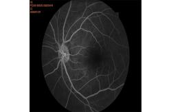 China 35mm Fundus Imaging System Equipment Auto Focus Shooting supplier